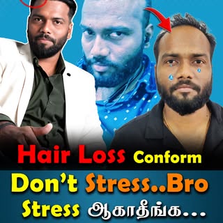 🥵🥹 Stress  ஆனா  இப்படி எல்லாம் ஆகுமா 🥹 😡
GET BACK YOUR CONFIDENCE
THROUGH SUKIRA's BEST TREATMEN