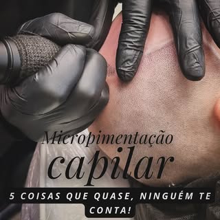 ✨ Micropigmentação Capilar: o que quase ninguém te conta!
👉 Arraste para o lado e descubra.

Chega 