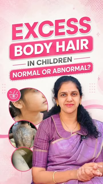 ✨ Excess Body Hair in Children – Should Parents Worry? 👧🏻

Does your child have more body hair on 