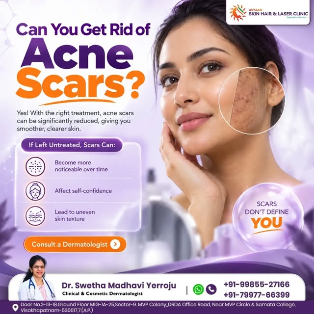 Can acne scars be treated? ✨

Yes! With the right treatment approach, the appearance of acne scars, 