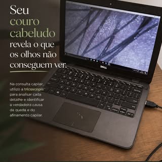 🔬 Seu couro cabeludo revela o que os olhos não conseguem ver.

Queda, afinamento, oleosidade, desca