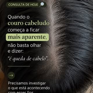 Consulta de hoje 🔍

Quando o couro cabeludo começa a ficar mais aparente, não basta olhar e dizer: 