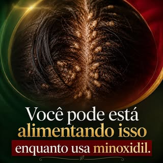 Você usa minoxidil, mas a queda continua? 👀

O minoxidil pode ser uma ferramenta importante no trat
