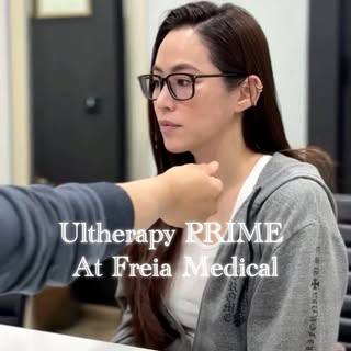 Ultherapy® Prime— a much needed treatment to lift & tighten skin and rejuvenate my face in a non-inv