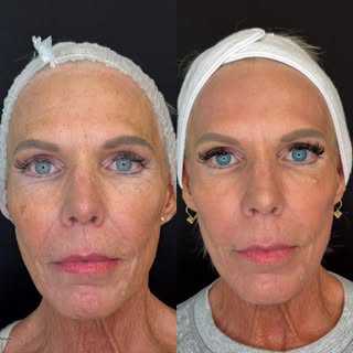 ✨ Glowing skin starts with the right treatment... and the results speak for themselves. ✨

Our beaut