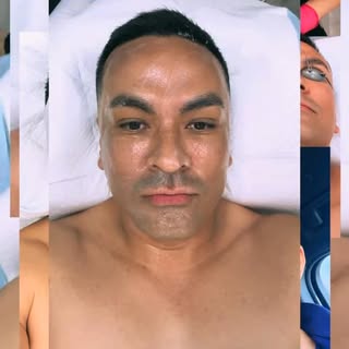 One of the perks of working with Plastic surgeons is that you get to try advanced cutting edge techn