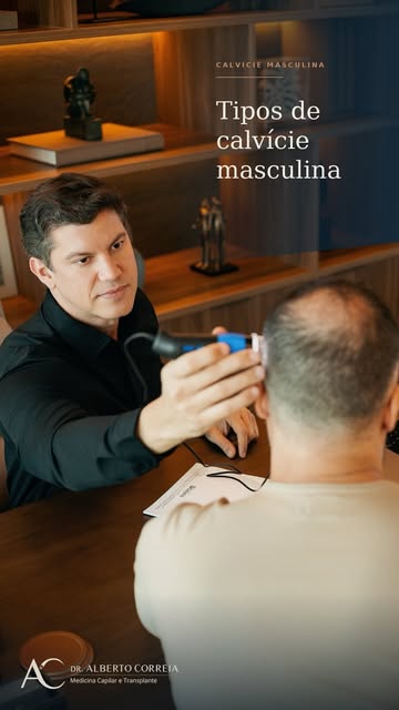 A calvície masculina pode se apresentar de diferentes formas. Identificar o padrão da perda é essenc