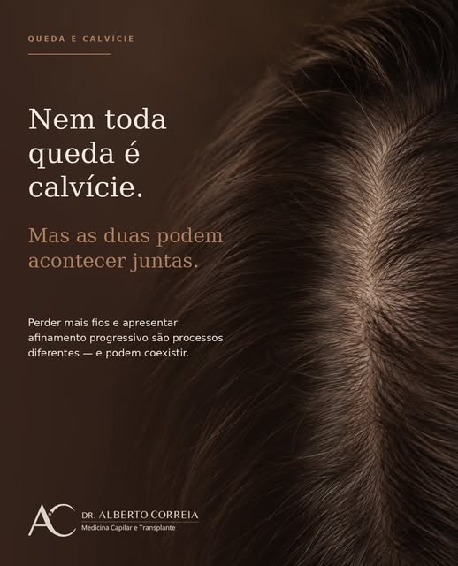 Nem toda queda é calvície, mas as duas condições podem acontecer ao mesmo tempo.

Enquanto a queda d