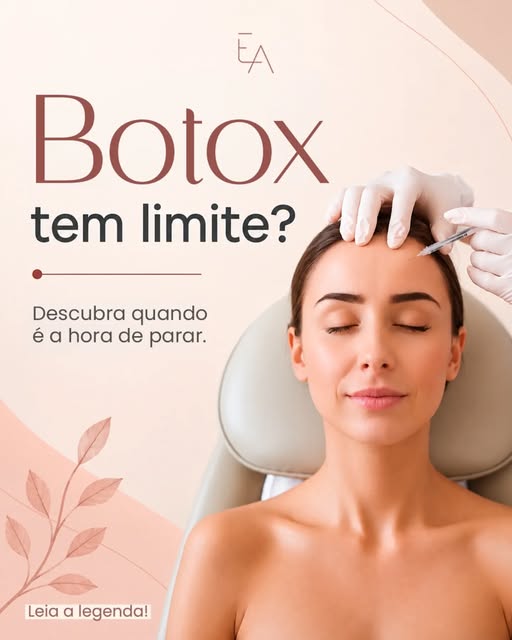 Sim, existe limite para a aplicação de Botox, tanto em quantidade por sessão como em intervalos entr