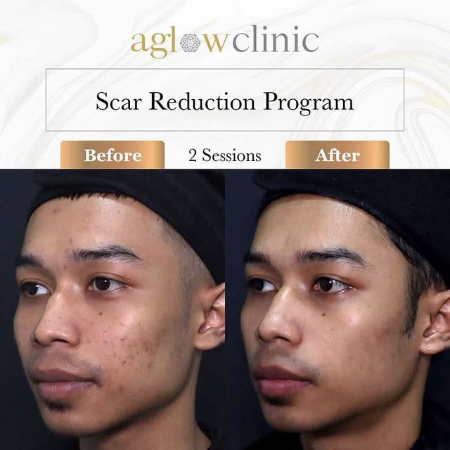 Only 2 sessions. Let that sink in! 🥹✨

We are so incredibly proud of this client’s progress on our 
