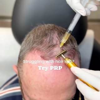 Unlock the power of hair restoration!

Hair loss can have a profound impact on one’s confidence. For