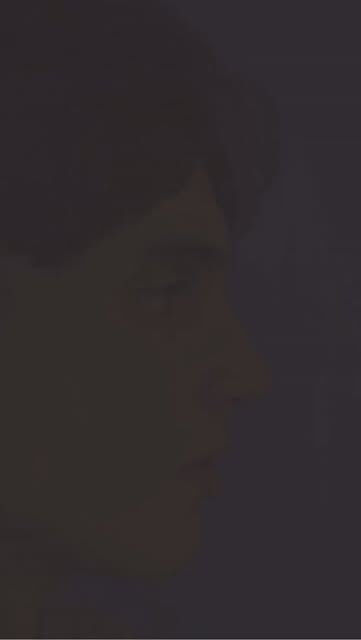 Revision Rhinoplasty for severely deviated nose, hump deformity and asymmetric nostrils. 

www.drnau