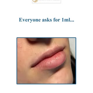 Everyone asks for 1 ml…
But not everyone needs 1 ml
Book your appointment with Prof. Dr Nauman Gill
