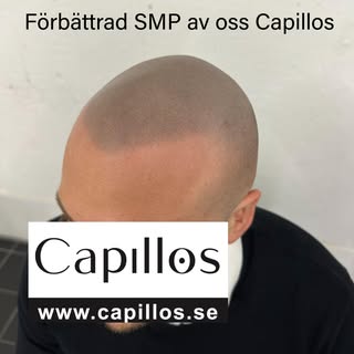 Kunden hade gjort smp hos annan studio. Efter 2 sessions hos oss på Capillos blev resultatet Deluxe 
