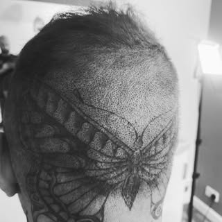 Hair transplant cover over Job - donor areas can leave bare skin which is a bit of a bummer and SMP 
