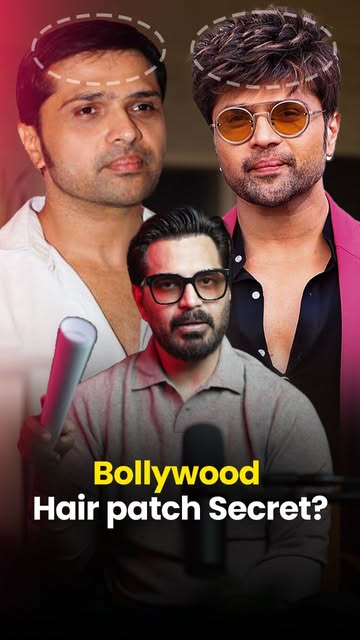 Bollywood actors… but their hair isn’t what you think.

Some have done multiple hair transplants.
So