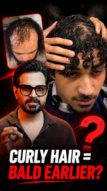 Does curly hair cause early baldness? 🤔

This myth is everywhere online.
But science says curly hai