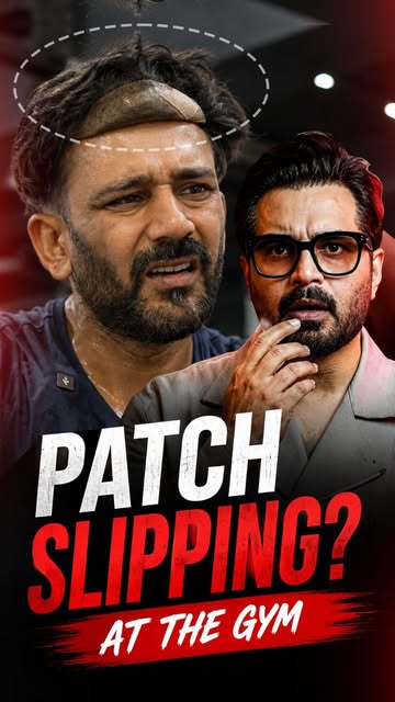 Why does your hair patch feel uncomfortable? 👀

The answer might not be the glue, fitting, or mater