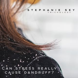 Can stress really cause dandruff?

Many people are surprised to learn that stress doesn't just affec