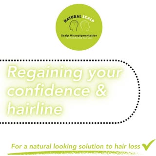 Regain back more than just your hairline, regain back your confidence with SMP treatment 💪
.

.
#ha