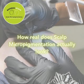 Scalp Micropigmentation | Hair Tattoo for Men & Women #hairtok #hairtattoo #hairscalp #hairscalp