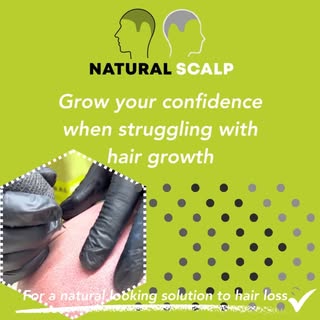 Hair Tattoo for Men & Women | Clinic in Cardiff #hairtattoo #hairlosssolutions #hairlossjourney