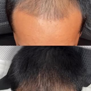 Say goodbye to thinning hair, hair loss, scalp and skin issues. A quick and convenient solution to r