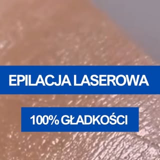 Pamiętam za to, jak kiedyś codziennie sięgałam po maszynkę. Jak walczyłam z podrażnieniami i wrastaj
