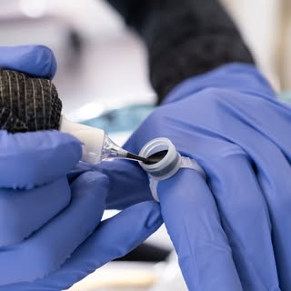My treatment involves tattooing tiny pigments into the scalp, imitating single hairs and hair follic