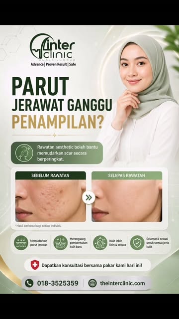 “Jerawat dah hilang… tapi parut masih tinggal.”
Kalau ayat ni terasa macam cerita anda, you're not a