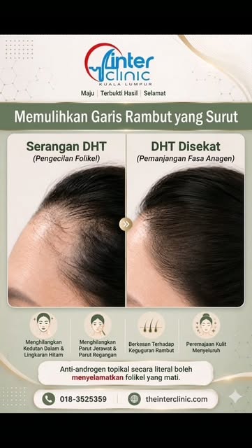 “Mungkin bukan dahi anda yang semakin besar.
Mungkin hairline anda yang semakin surut.” 👀
Perubahan