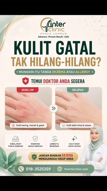 “Kenapa kulit aku masih gatal walaupun dah cuba macam-macam?” 😣

Kalau soalan ini pernah bermain da