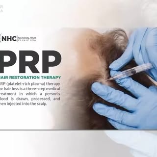 #PRP is a great option for starting the Restoration process of hair loss!