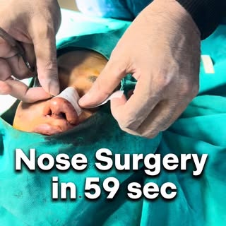 Nose Surgery in 59 sec
.

.
#cosmeticsurgery #nosesurgery #rhinoplasty