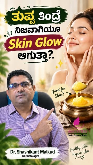 ತುಪ್ಪ ತಿಂದ್ರೆ ಮುಖ ಪಳಪಳ ಹೊಳೆಯುತ್ತೆ!” ಅಂತ ಕೇಳಿರಬಹುದು… ಆದರೆ ನಿಜ ಏನು? 👀

ತುಪ್ಪದಲ್ಲಿ fat ಇರುತ್ತದೆ. ನಮ್ಮ 