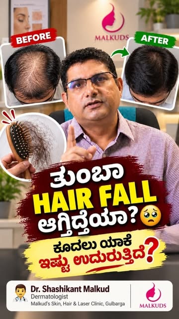 ತುಂಬಾ hair fall ಆಗ್ತಿದೆಯಾ? 😟
Hair wash ಮಾಡಿದಾಗ ಕೈ ತುಂಬಾ ಕೂದಲು ಬರ್ತಿದೆಯಾ?

“ಇದು ಯಾಕೆ ಆಗ್ತಿದೆ?” ಅಂತ ನ