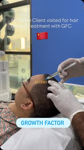 Here is our Chinese 🇨🇳 patient who visited us for severe hair loss and hair thinning.
He is regula