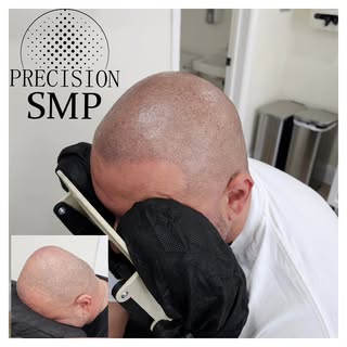 The results speak for themselves. 🤌

#smp #scalptattoo #scalpmicropigmemtation  #hairloss #scalpmic