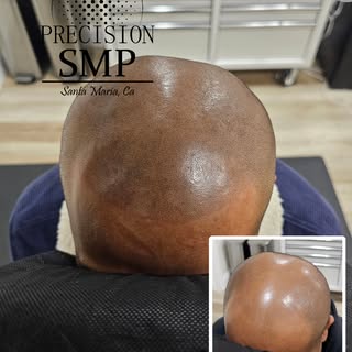 Another day, another transformation to bless our eyes. This client had 3 sessions to accomplish this