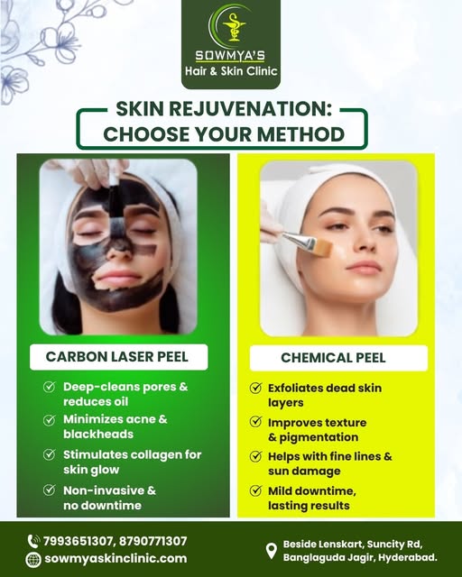 Refresh Your Skin, Your Way!
From Carbon Laser Peel to Chemical Peel, choose the right approach for 