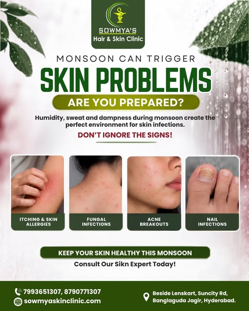 Skin Treatment In Hyderabad for healthier, clearer skin starts with the right care. Monsoon can trig