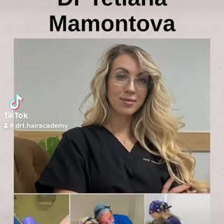 #drtetianamamontova #hairtransformation #hair #hairtransplant #fue #haircare #surgery