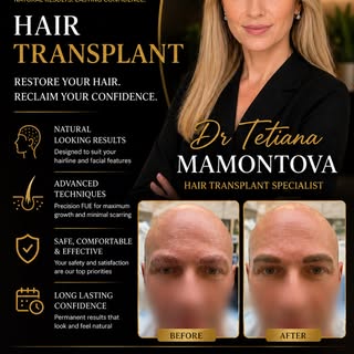 Every hairline is designed, not guessed.

✔️ Facial proportions
✔️ Donor management
✔️ Natural direc