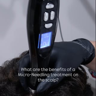 Microneedling for the scalp is a trichology treatment that uses tiny needles to stimulate collagen p