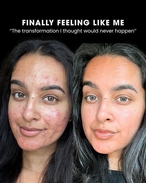 More than just a skin transformation...

These are the moments that remind us why we do what we do. 