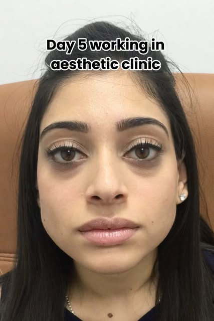 THEN & NOW 👀

This is what your aesthetic journey can look like when you trust Dr Medispa🤍

We’re 