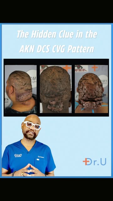 .

.The most important clue may be hiding in scalp that looks normal.

In three patients, we documen