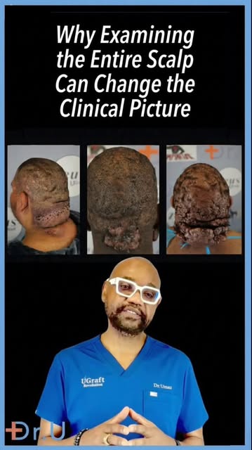 .

.Could three serious scalp conditions be part of one emerging clinical pattern?

In three patient