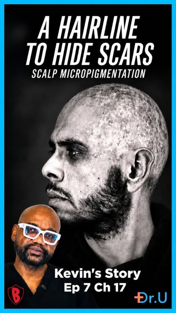 .

.How do you create a natural-looking result on a scalp changed by severe disease and scarring?

W