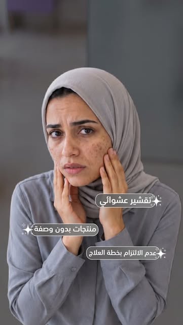 تصبغات وآثار الحبوب مو قاعدة تتحسن؟ 🤔
يمكن المشكلة مو ببشرتج… يمكن بطريقة العلاج!

التقشير العشوائي
